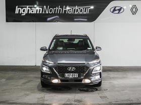 2017 Hyundai Kona | 2.0 ELITE FWD | 29777 | 5